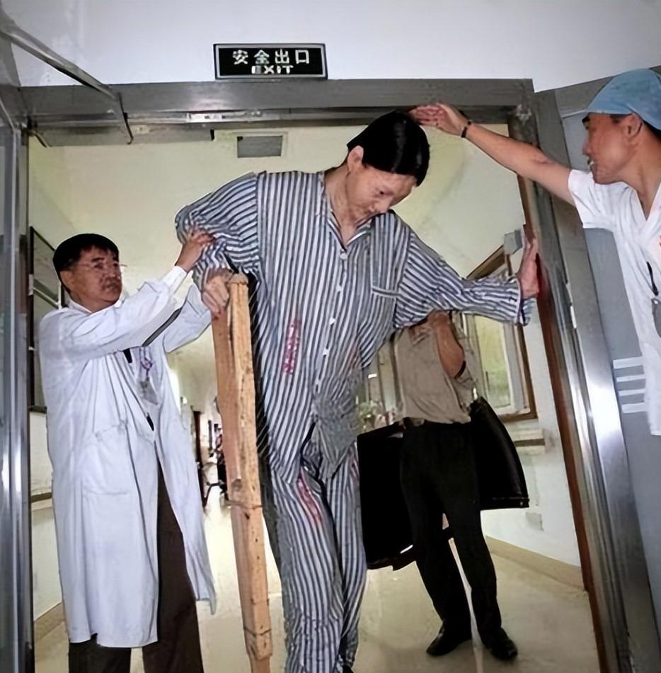 纪实"女巨人"姚德芬:身高2.36米穿鞋78码,一顿饭吃将近一锅米饭