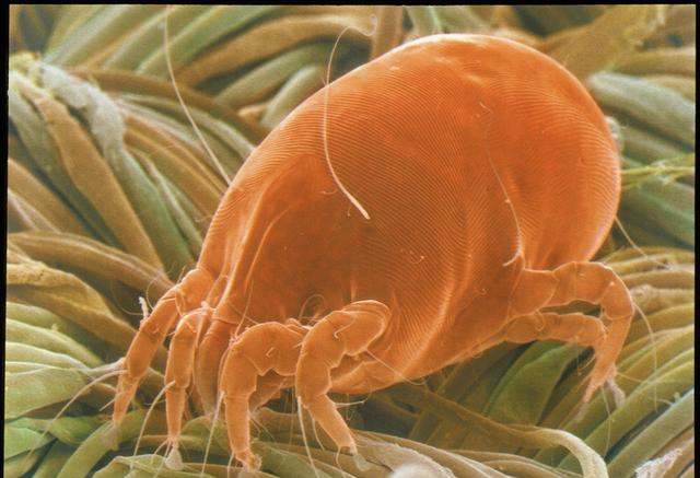 螨虫会传播,导致哪些常见疾病?