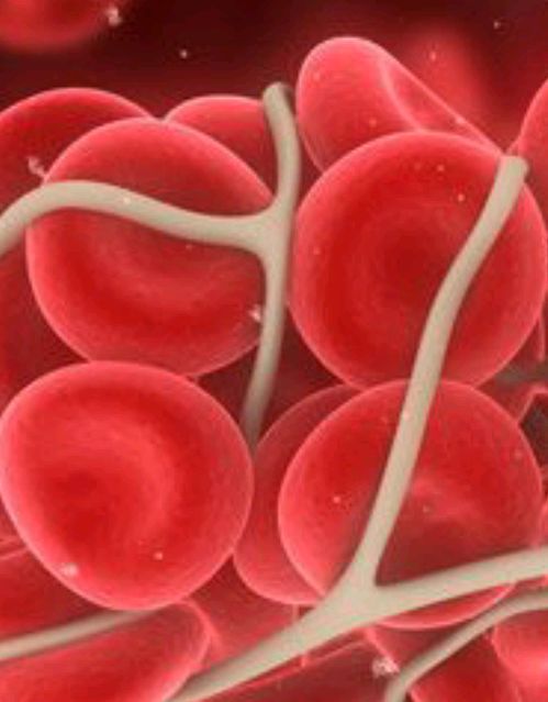 化验血清结合珠蛋白增高,是怎么回事?