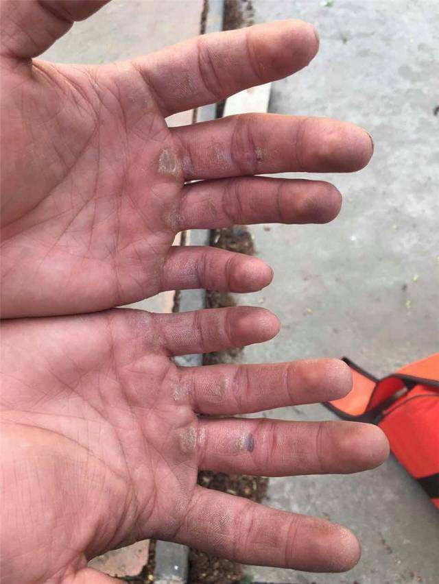 无法用岁月抹出的痕迹,父亲手上的老茧