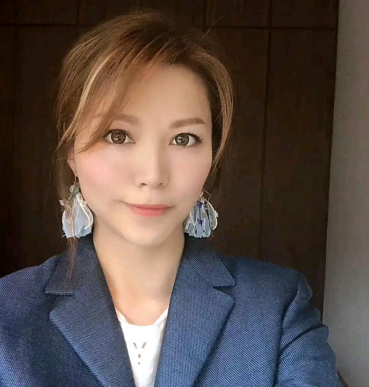 香港知名女星撞上玻璃门,头上起鸡蛋大肿包