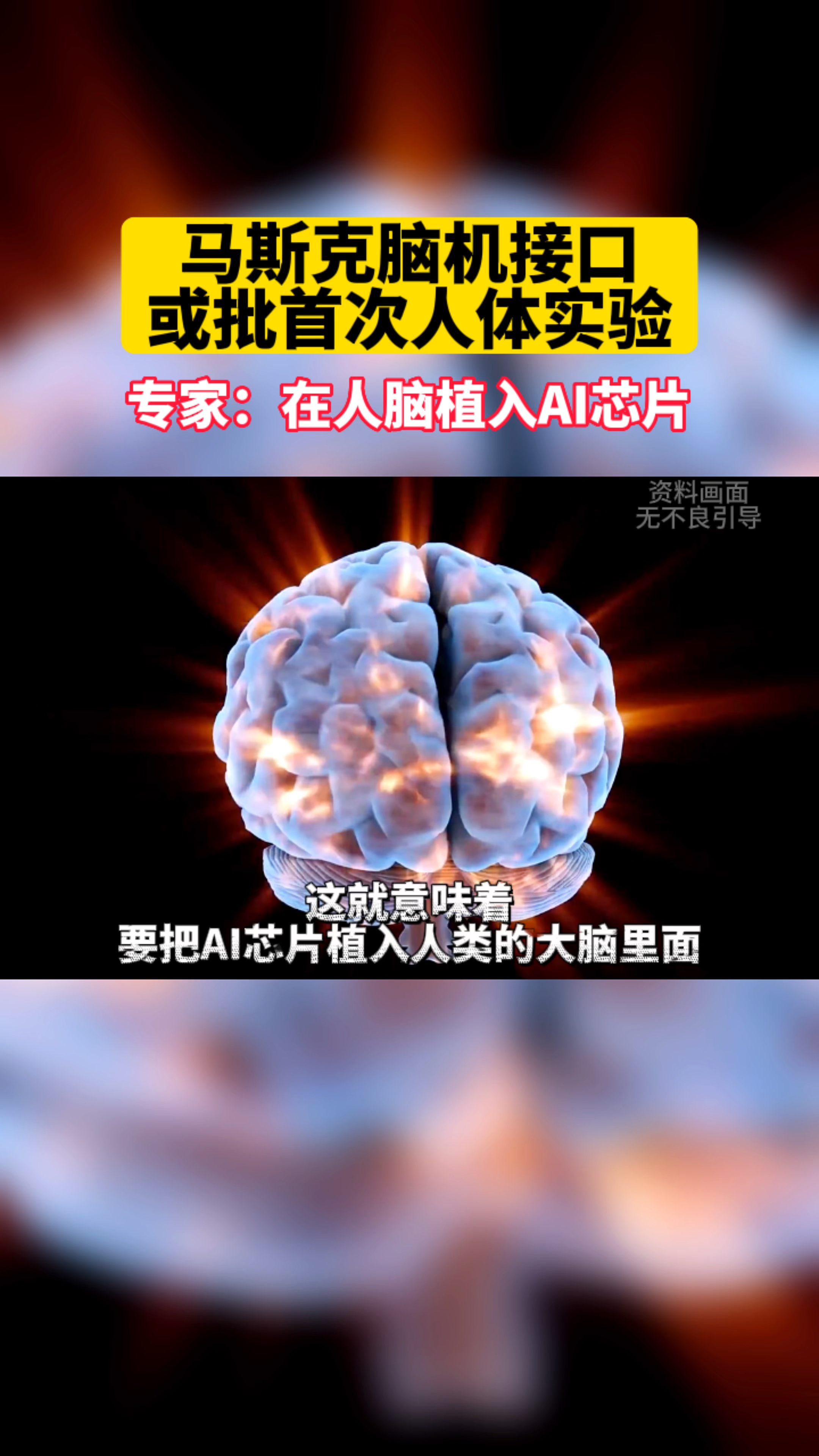 马斯克脑机接口或批首次人体实验!专家表示:在人脑植入ai芯片!