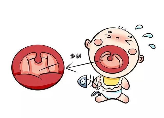 3岁孩子被鱼骨卡住,父母科学救娃避雷区,医生都来点赞