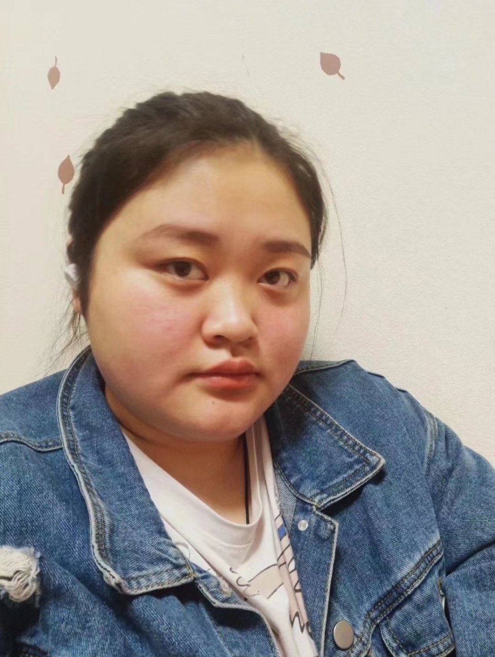 甲减已经过去,健康人生刚刚开始#甲减