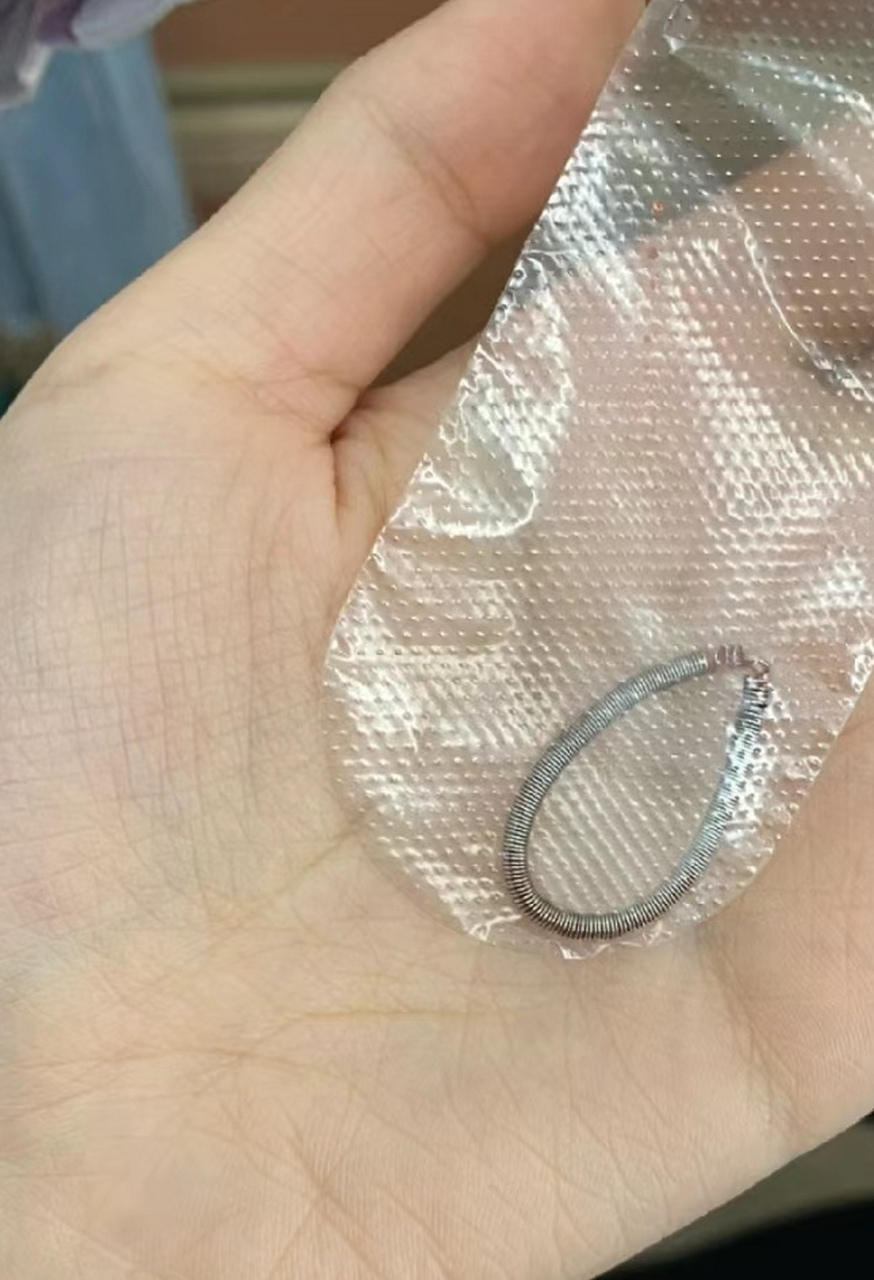 从妈妈身体里取出来的节育环,这是一个很短很短的全麻手术,危险性很小