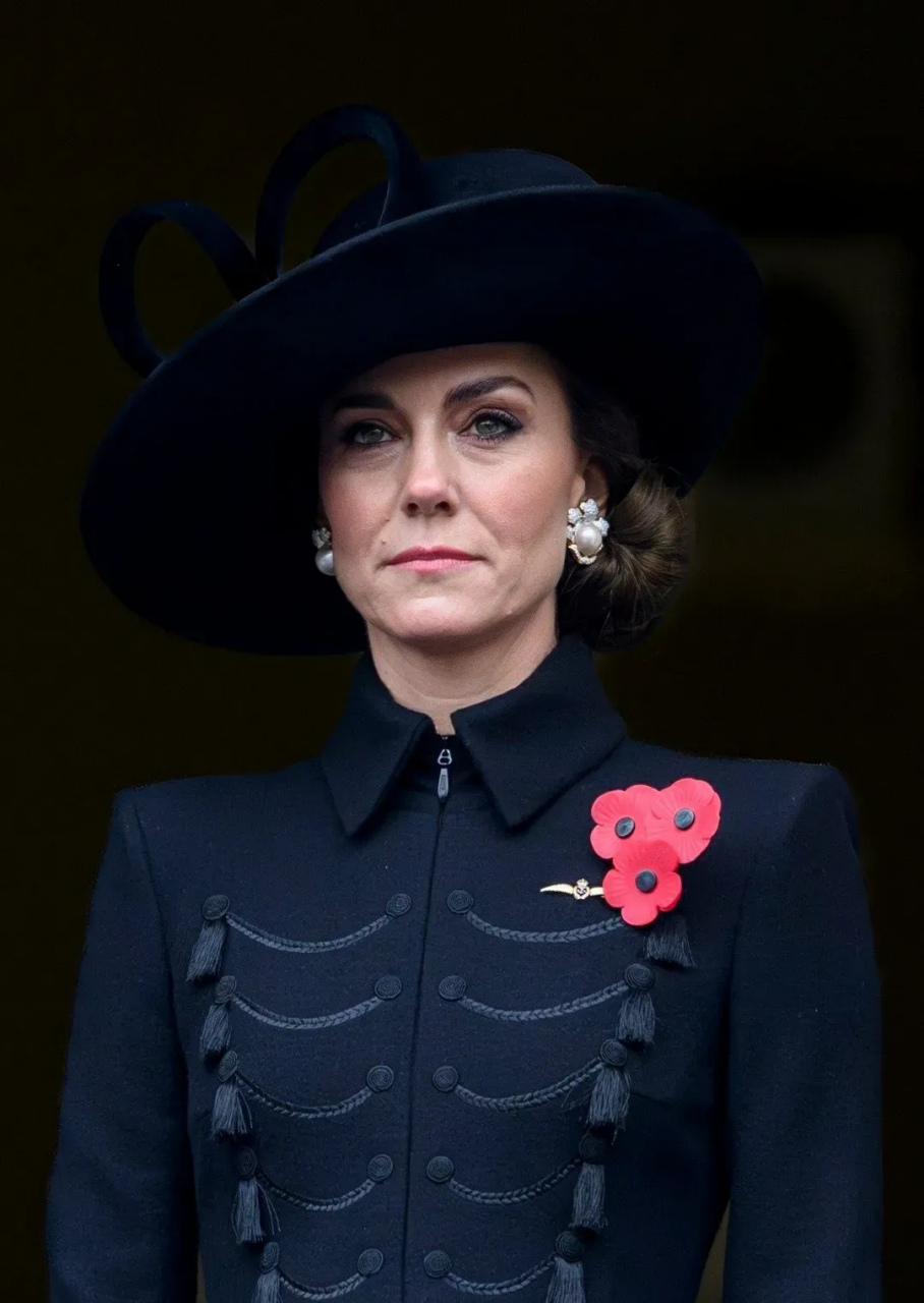 大家常说:一个女人幸不幸福,从面相上就能看出来～梅根比凯特大5个月