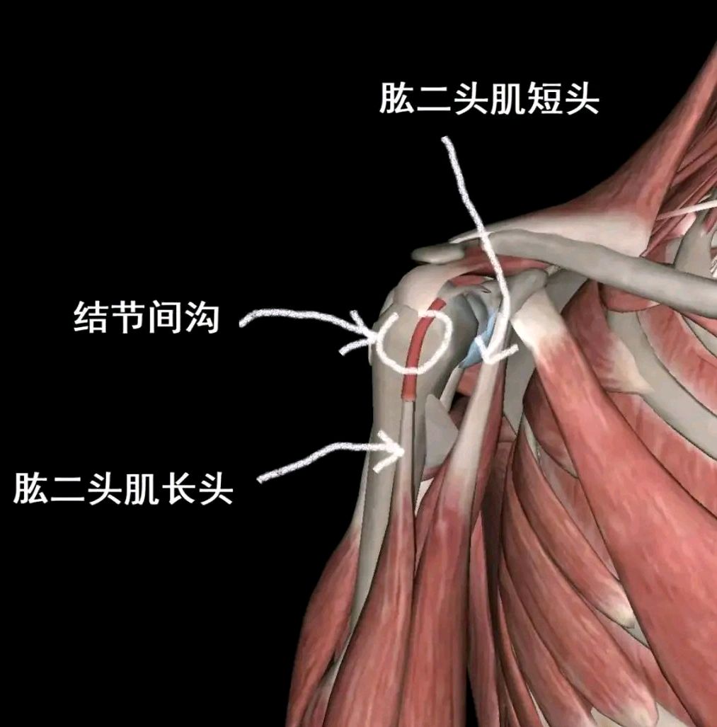 喙肱肌肌腱炎图片