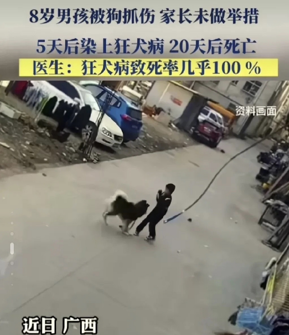 八岁男孩狂犬病发作离世.