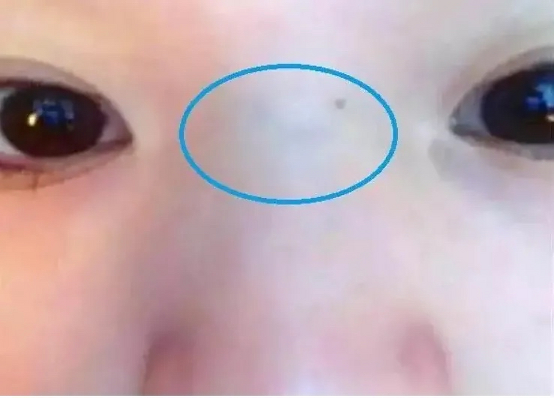 孩子鼻梁发青发暗,鼻梁也称山根,中医里,如《小儿药证直诀》中讲到"鼻