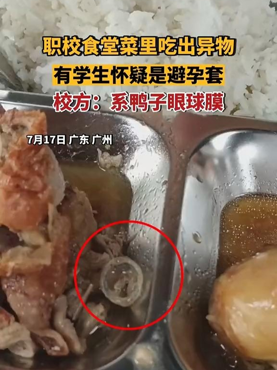 校方:鸭子眼球膜.