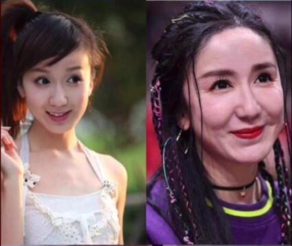 盘点整容失败的明星,第四位差点毁容!最后一位网友直呼老巫婆