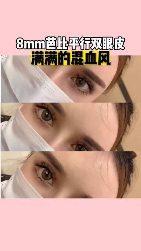 8mm芭比平行双眼皮,这种感觉喜欢吗?-度小视