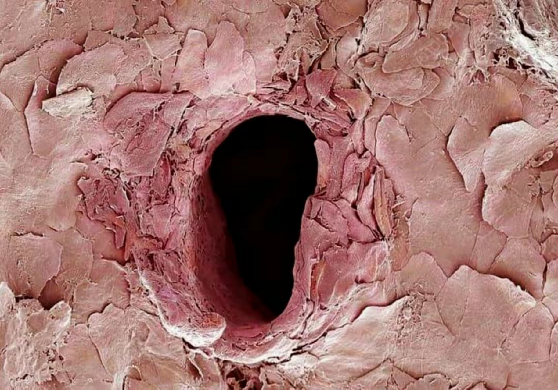 这是人体打针后,皮肤上的孔洞,在显微镜下的样子.