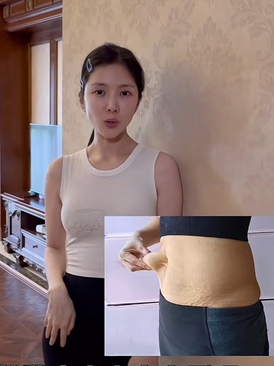 杜淳老婆生完女儿两年多还有妊娠纹,王灿大方晒出自己当妈妈以后变松