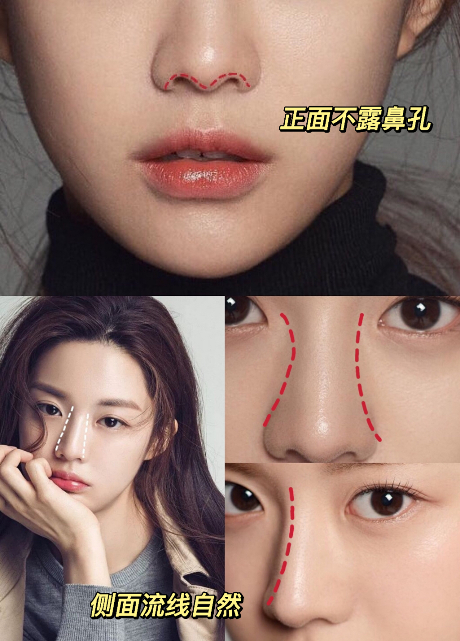 韩国最标准的整容模板高允真,非常自然,看不出整容痕迹!