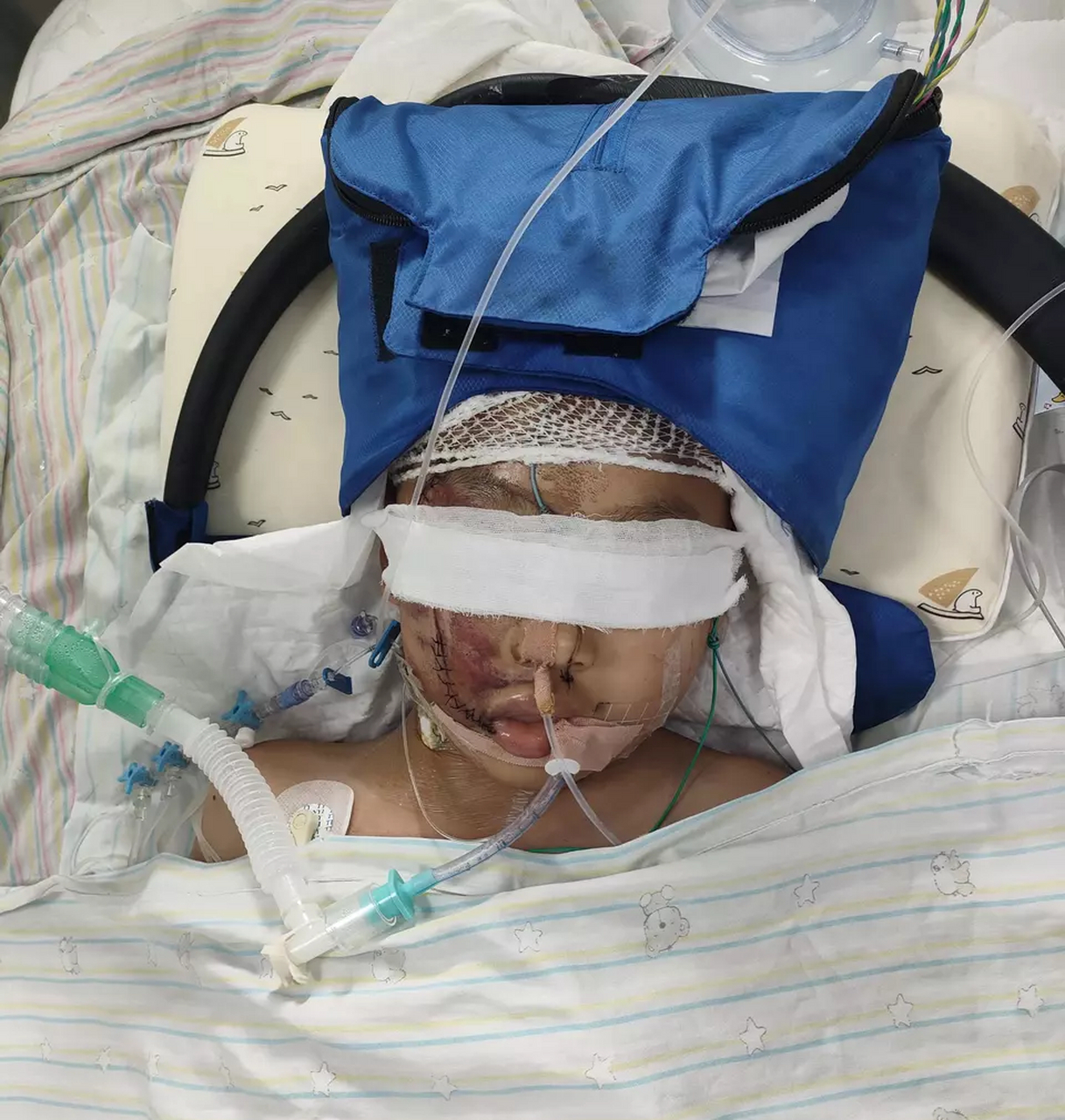 近日网上纷纷报道"10岁孩子被跳楼者砸中昏迷不醒",真是飞来横祸,孩子