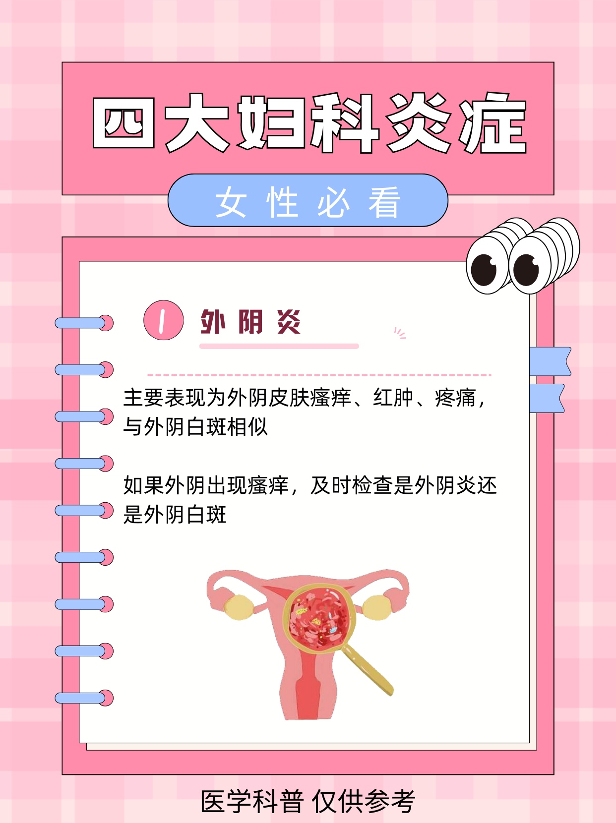 四大妇科炎症,女性必看