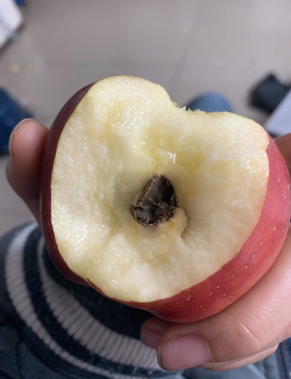 网友:吃苹果咬了一大口,现在都已经吃进肚子里了,这种情况,应该没事吧