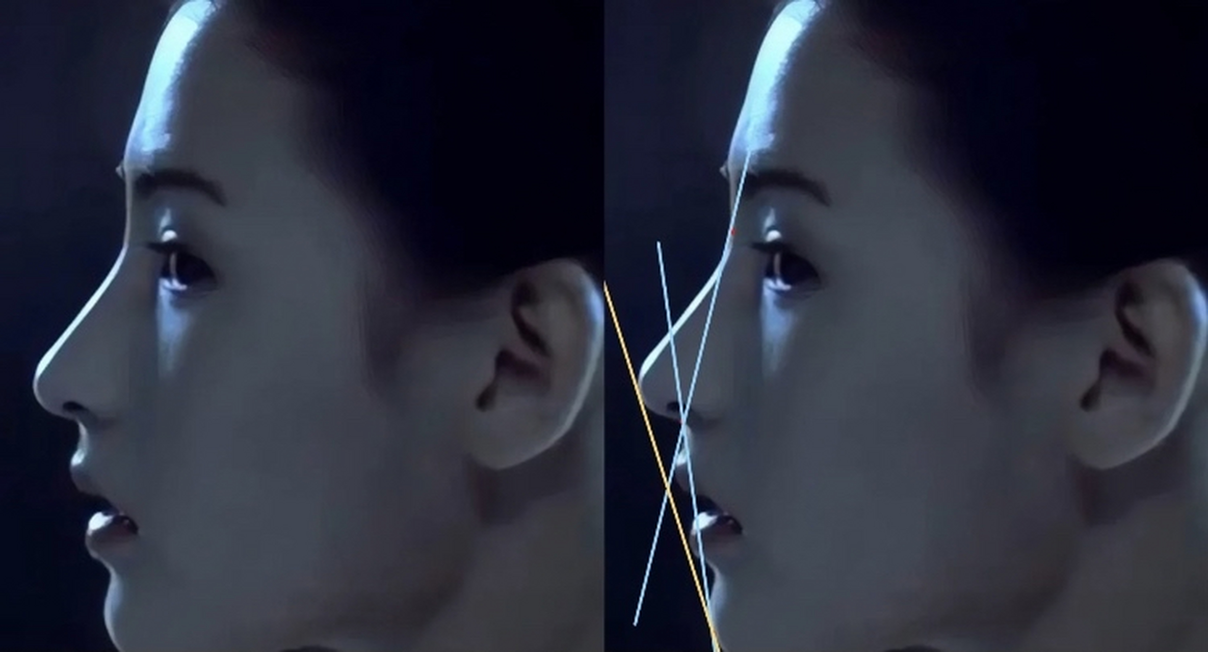 其实凸面型才出美女. 张柏芝/迪丽热巴/林青霞/阿娇.