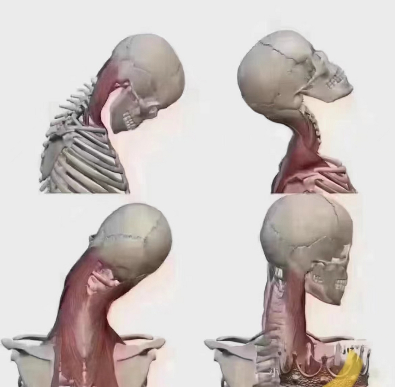 颈椎有四个运动方向 前屈~后伸~侧屈~回旋 不要做360°绕脖子的动作啦
