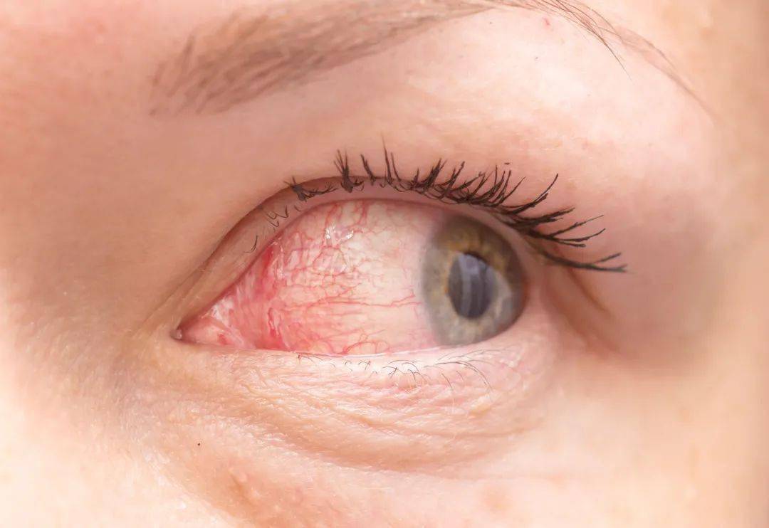 眼睛干痒酸痛不适,5穴位给眼睛"补气血"