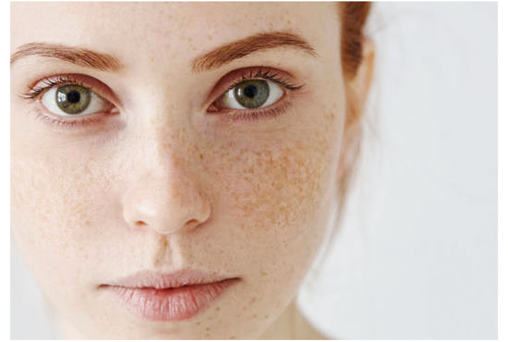 评选淡斑祛斑效果排名第一护肤品