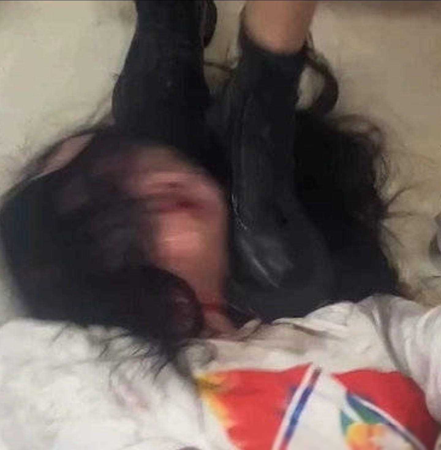 揪心!长沙女生遭霸凌后割喉,现场画面曝光,打人者发朋友圈炫耀