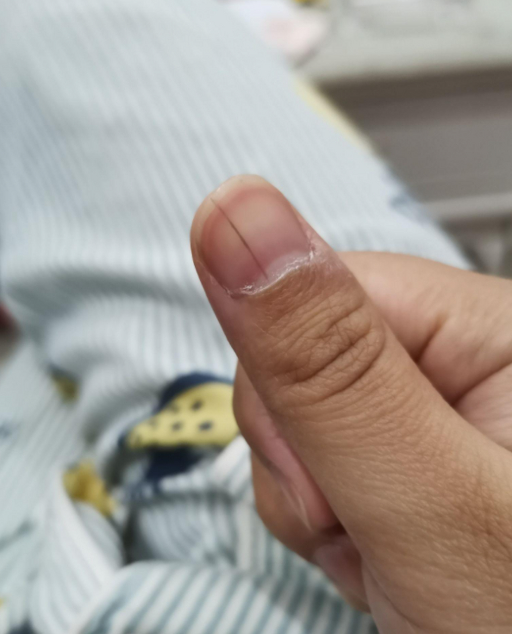 [原文:为什么有人指甲上有月牙,.