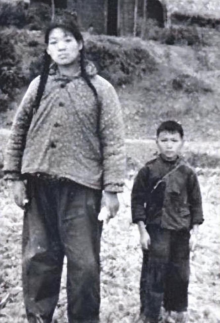 湖南女子曾金莲身高竟达247厘米,因罕见脑垂体肿瘤成巨人.