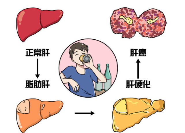 工作熬夜伤肝成通病?哈佛"净肝"科技强势崛起,遭中产群体青睐