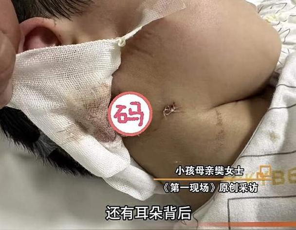 流浪狗咬人居民怎么办(流浪狗咬人案例及争议焦点)