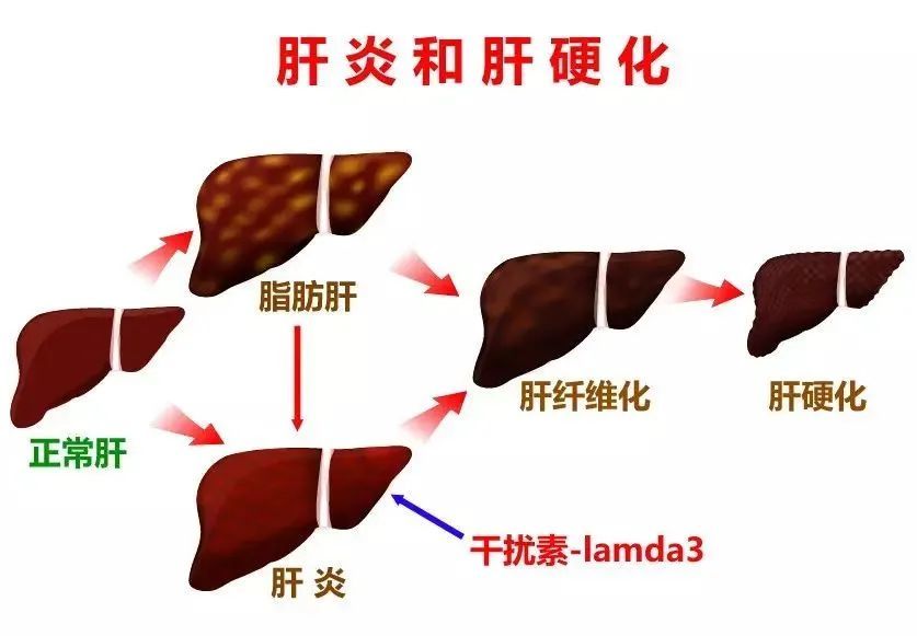 5亿肝虚人有福了?科学家72周改变六大指标