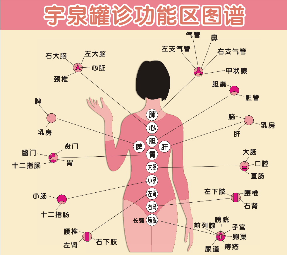 省级非物质文化遗产项目 李氏脊柱拔罐诊疗法