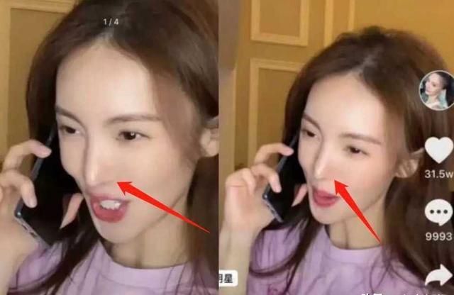 "森白牙,巫婆鼻,刀削脸",演艺圈的明星,真是把脸玩"透"了