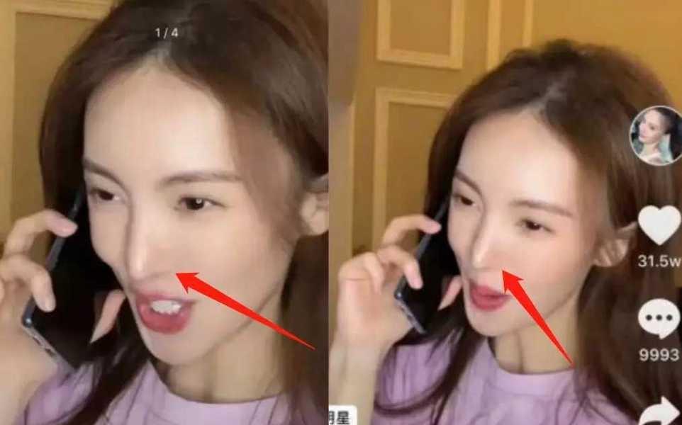 "森白牙,巫婆鼻,刀削脸",演艺圈的明星,真是把脸玩"透"了