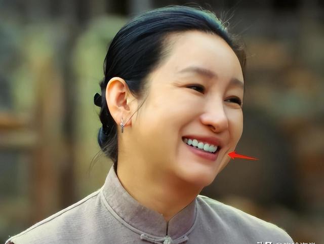 "森白牙,巫婆鼻,刀削脸",演艺圈的明星,真是把脸玩"透"了