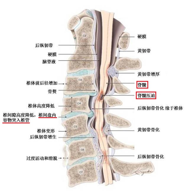 颈椎五六七节压迫神经图片