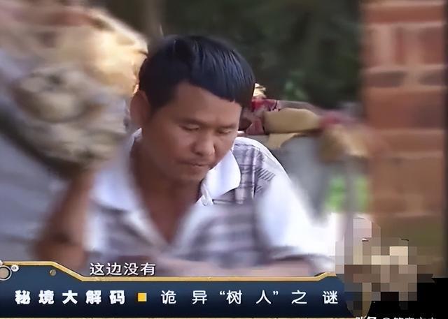 男子得怪病变成树人图片