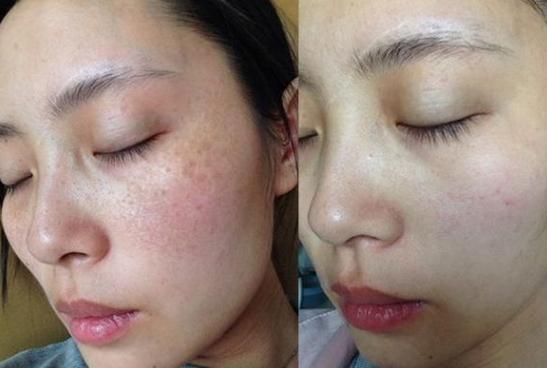 真实使用感受推荐,淡斑效果排名第一,这样选不会出错