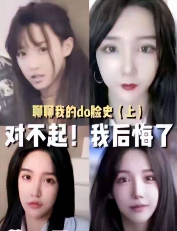 脸部前后60次"修容",变性网红艾比分享整容经历,坦言:后悔了