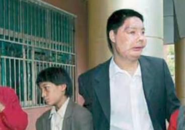 中国换脸第一人李国兴,2006年背60斤西药回家,两年后离奇去世