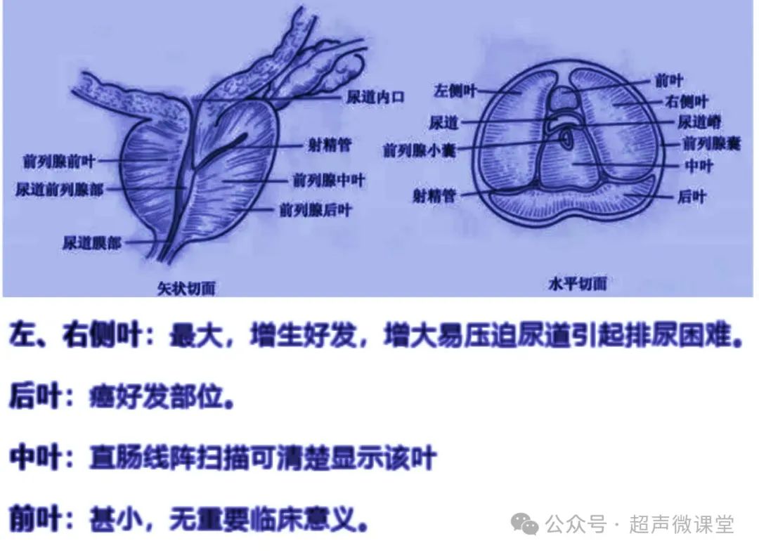 前列腺常见病的超声表现