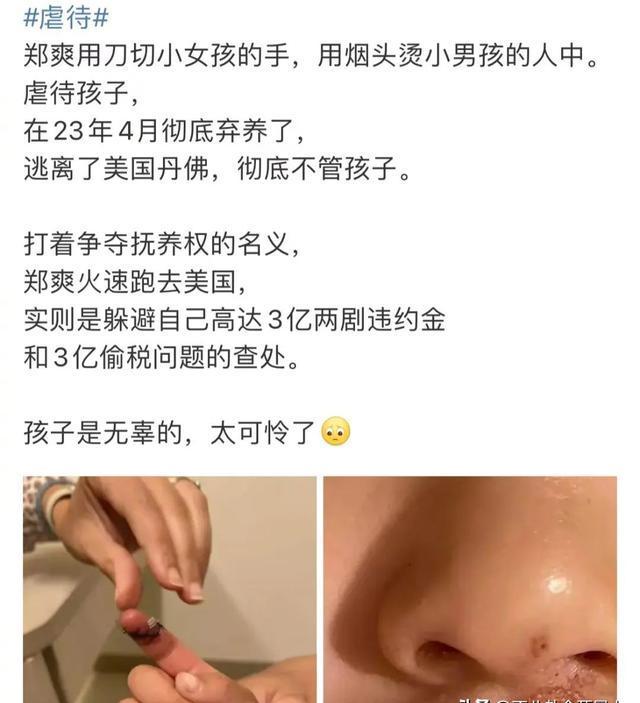 郑爽弃婴事件图片