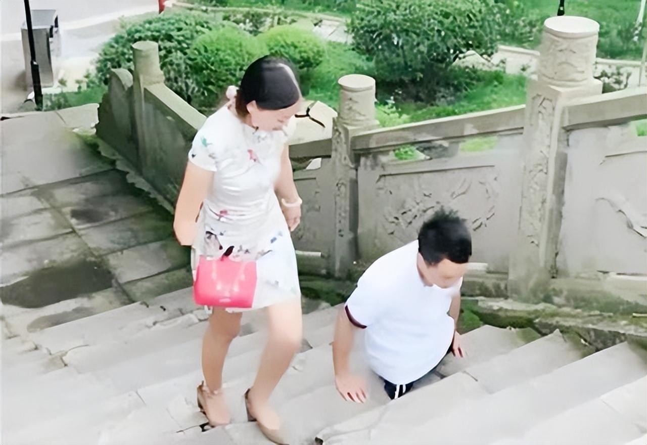 连体夫妻分手图片