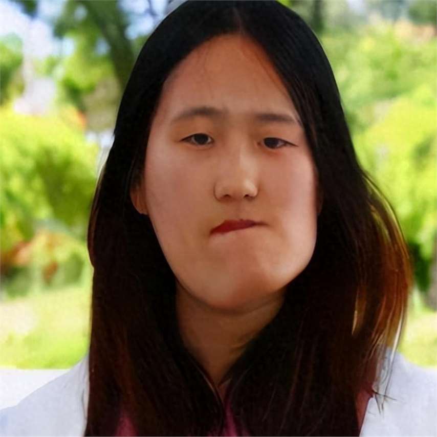 辽宁歪脸女孩,父母双亡,她整容变女神,拒百万年薪,只想当老师