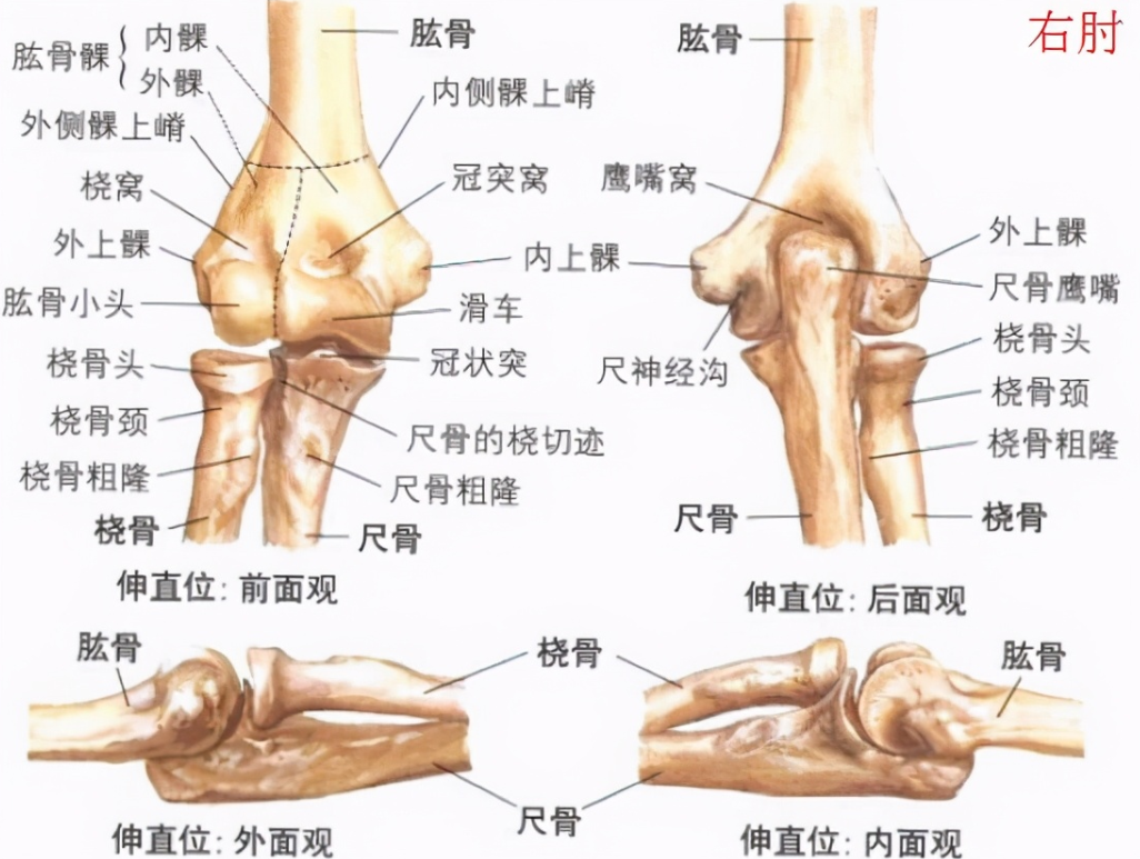 全肘关节置换让僵硬肘"能屈能伸"