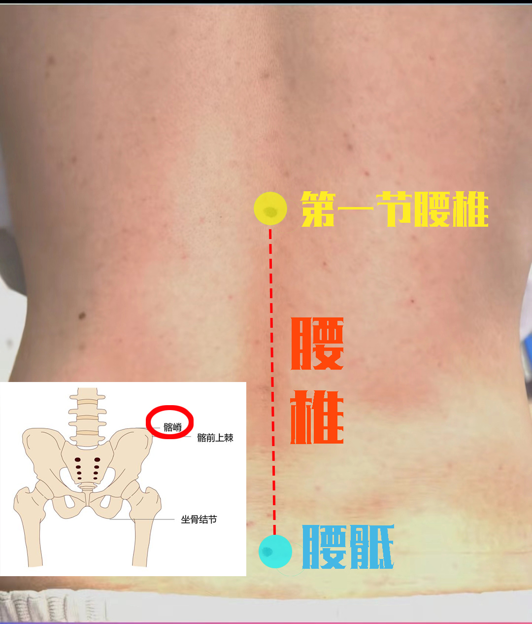 不同位置的腰痛,原因都有哪些?医生手把手教你区分