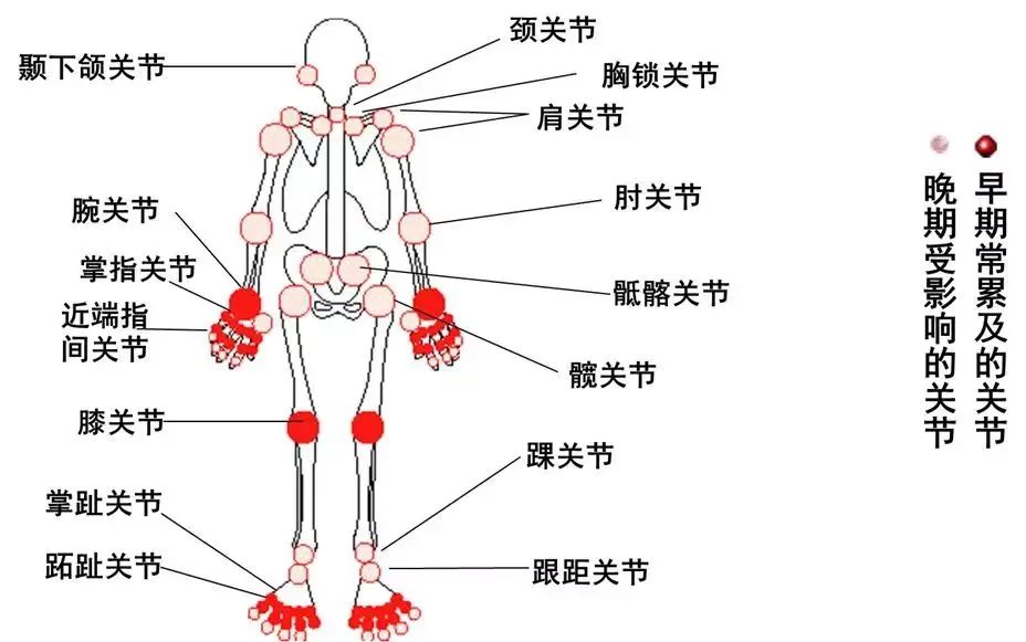 关节结构图初二生物图片