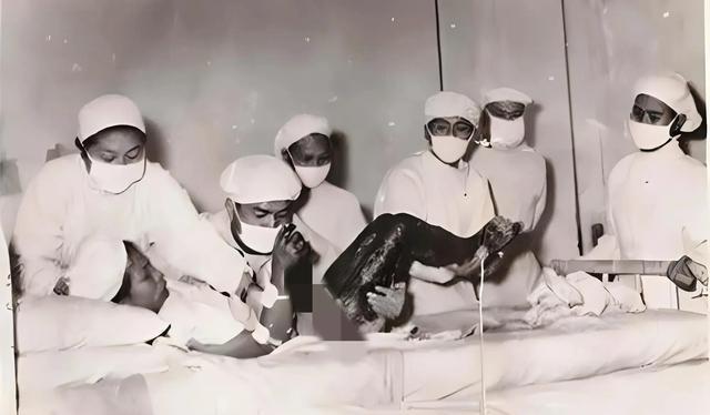 向秀丽:1959年的救火英雄,因伤势过重英勇牺牲,罕见治疗镜头