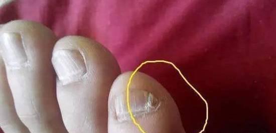若你的小脚趾有两瓣甲,或许不是纯正汉人,而是鲜卑族的后代?